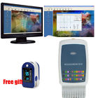 190891404862 Handheld Contec Resting Ekg Machine Cardiograph Software Gift