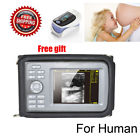 190891446732 Carejoy 5.5 Handheld Ultrasound