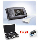 190891787095 Handheld Ultrasound Scanner Digital