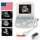 668817420170328122 Carejoy Ultrasound For Pregnant 190891778420