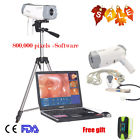 668817420170328137 Carejoy Pixels Video Electronic Colposcope Sony Gynecology Vaginal 190891535436