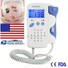 8431257557061 Sunshine Fda Handheld Fetal Doppler Fetus Monitor Gel