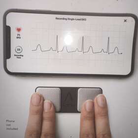 Alivecor 711181391725 Kardiamobile Personal Ekg Device And Heart Monitor Single-lead 3 Detections
