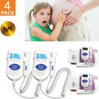 By01hmzc49710002 Unbranded Sonoline B Fetal 791658545349