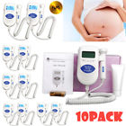 Gn12zc49710001 Unbranded Sonoline B Fetal