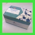 Ide-25-pbc Diagnosus Fecal Occult Blood
