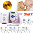 Sg02hszc49710002 Unbranded Sonoline B Fetal
