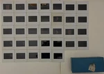 28 Color Transparency Breast Cancer Slideshow Diagnosis & Treatment 1980S. Fixed Price $48.00.