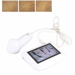 Skin Diagnosis Hair Analyzer, 5 Inch Lcd Screen Digital Detector Tester. Fixed Price $198.52.